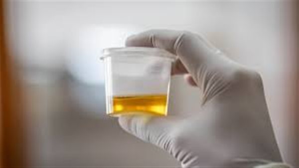 طرق إجراء تحليل البول