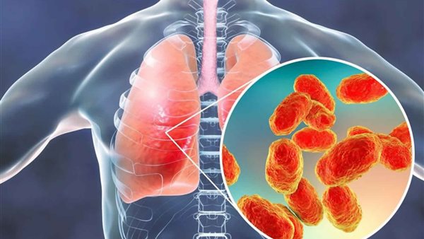 فيروس Metapneumovirus