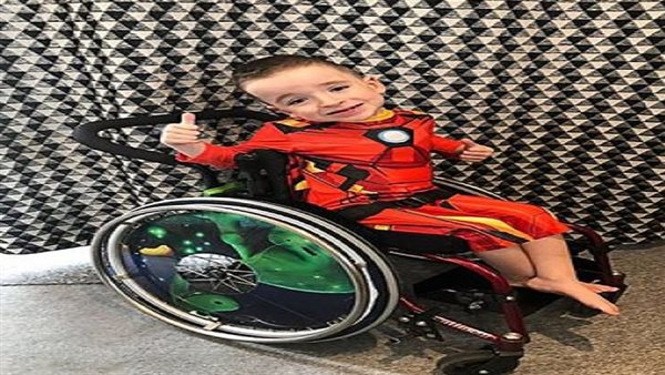 أسباب مرض العظم الزجاجي