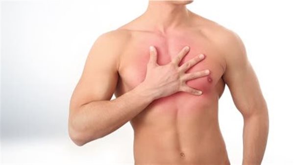 طرق طبيعية لعلاج