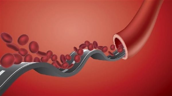 أسباب فرط بوتاسيوم