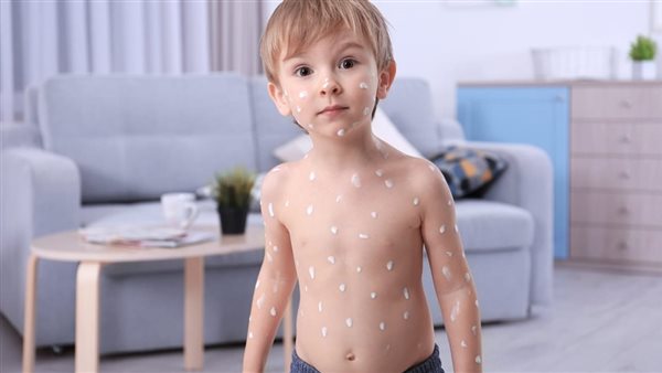 أسباب البقع البيضاء