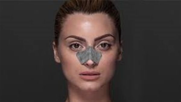 أعراض متلازمة الأنف