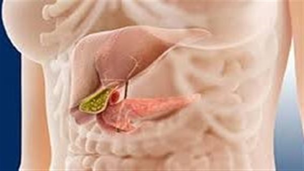 علاج انسداد القناة