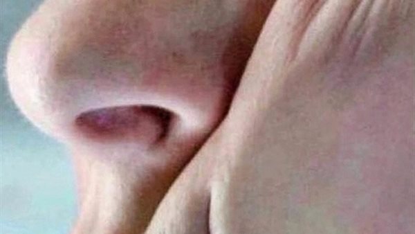 تجاعيد النوم.. أرشيفية