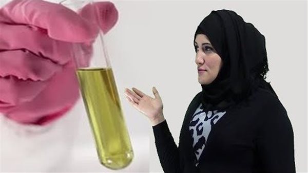 أسباب ارتفاع الأسيتون