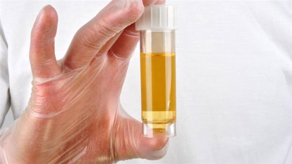 مزايا وعيوب استخدام