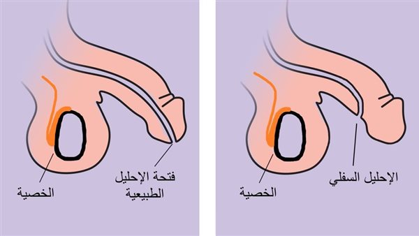 الإحليل السفلي..