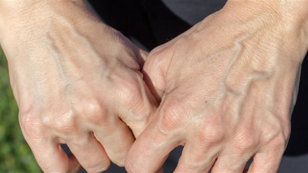 علاج العروق الخضراء