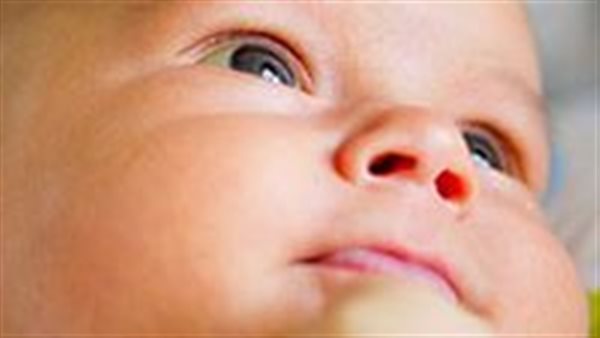 أعراض يرقان الرضع