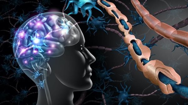 أعراض التصلب المتعدد