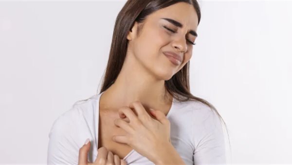 حساسية الطعام