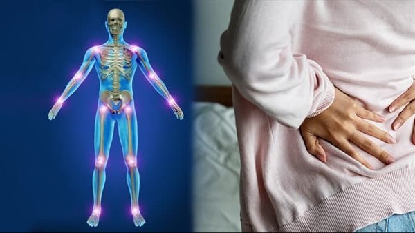 متلازمة الألم العضلي