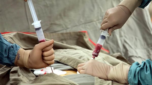 الخلايا الجذعية لعلاج