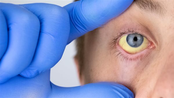علاج التهاب القنوات