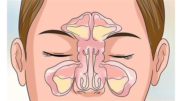 علامات على الأنف