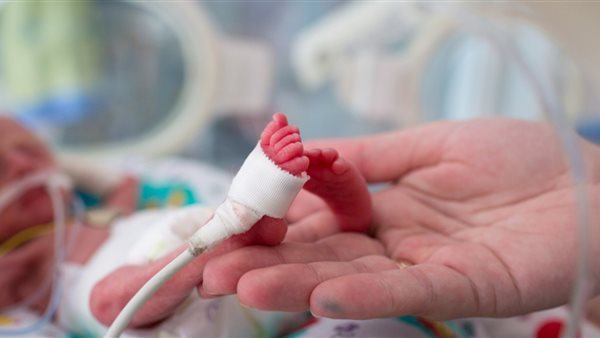 الأطفال الخدج.. أرشيفية