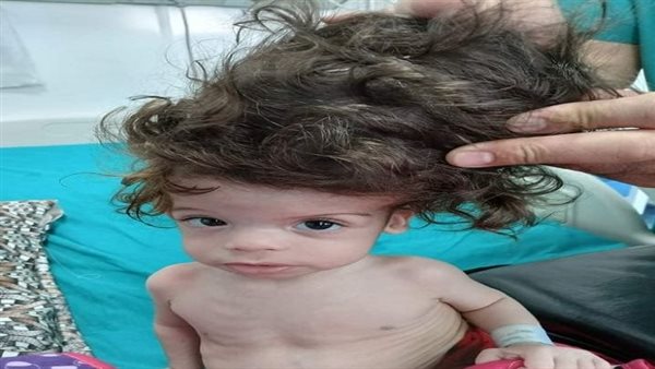 للمرة الأولى بجامعة الإسكندرية..
