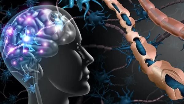 مرض التصلب المتعدد