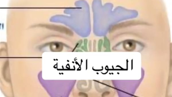 الجيوب الانفية