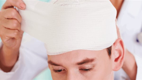 إصابات الرأس
