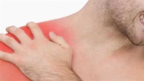التهاب عضلات لوح