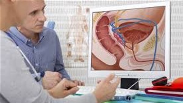 أعراض سرطان البروستاتا