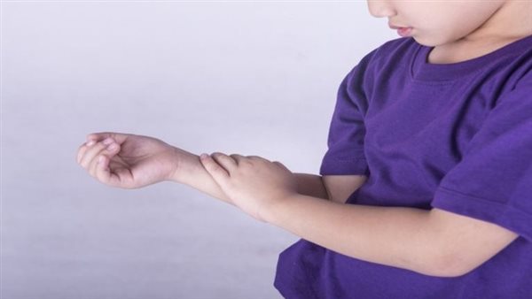 أنواع روماتيزم الأطفال