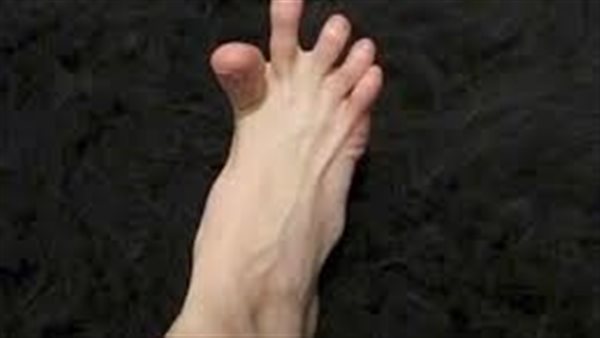 أسباب تشنج أصابع