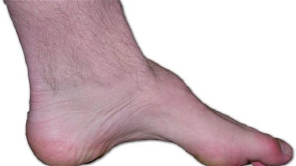 القدم الكهفية.. أرشيفية