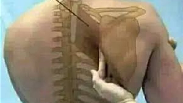 متى يكون الأبهر خطيرَا؟