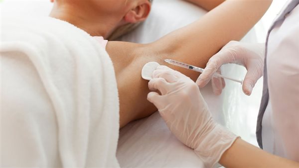 كيف أوقف فرط التعرق؟