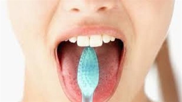 كيف أعالج تشققات
