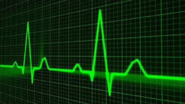 أسباب متلازمة فترة QT