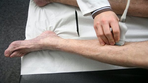 علاج متلازمة انحباس