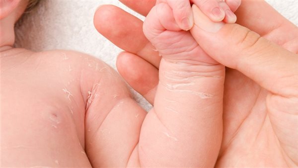 الأمراض الجلدية عند