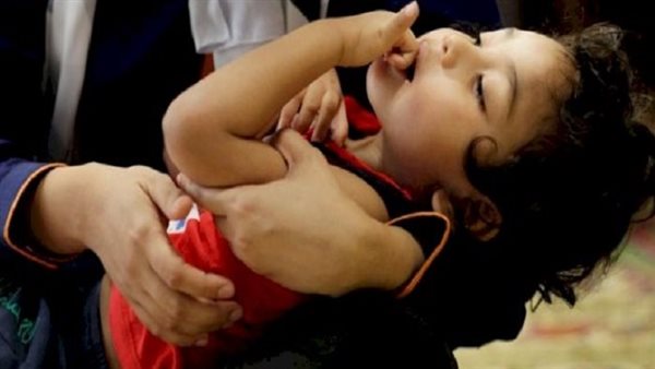 أعراض الشحنات الكهربائية
