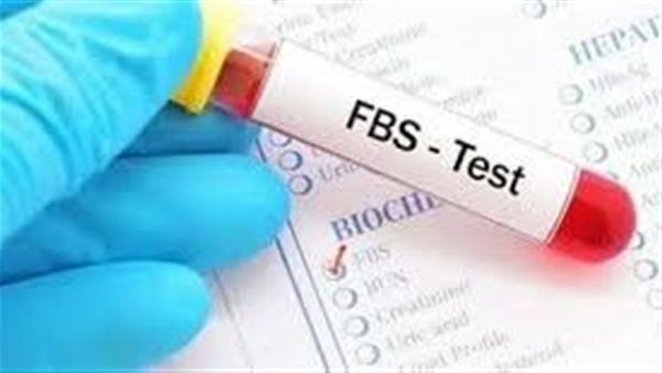 تحليل FBS