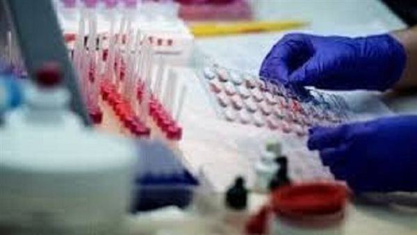 علاج متلازمة فيكساسVEXAS