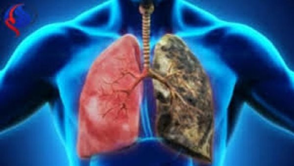 أعراض أمراض الرئة
