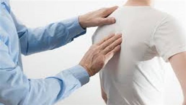 أسباب تقوس الظهر
