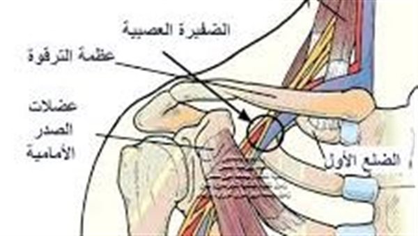متلازمة مخرج الصدر