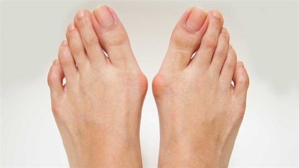 أعراض البروز العظمي