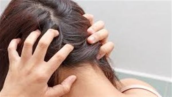 حكة فروة الرأس..