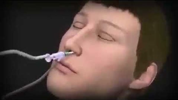 كيف تجرى جراحة توسيع