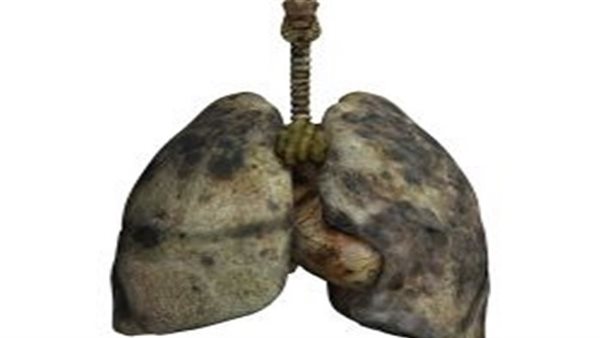 ما هو مرض الرئة السوداء؟