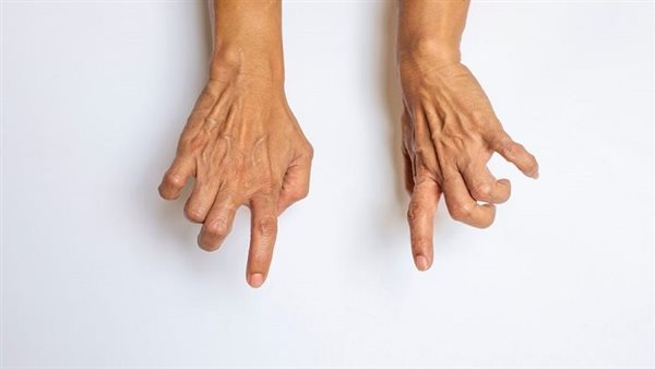 أسباب تشنج أصابع