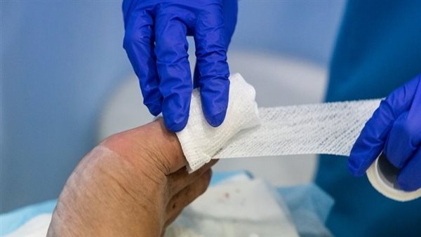 ما هو علاج الفطار