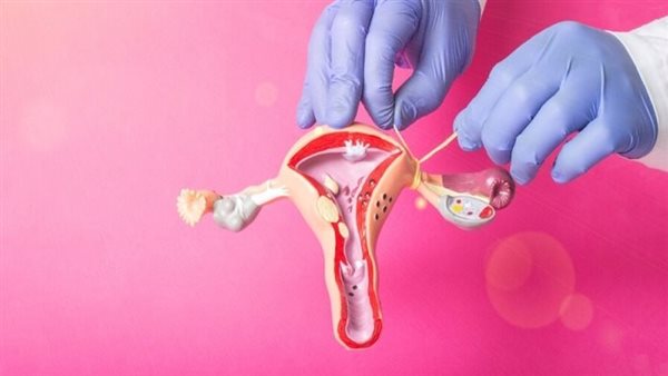 هل هناك علاج للرحم