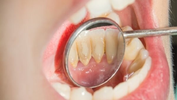 علاج العيوب الخلقية